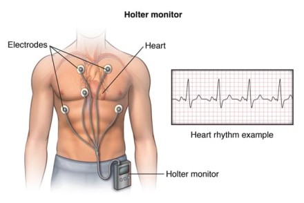 holter-schemat-1698871158.jpg